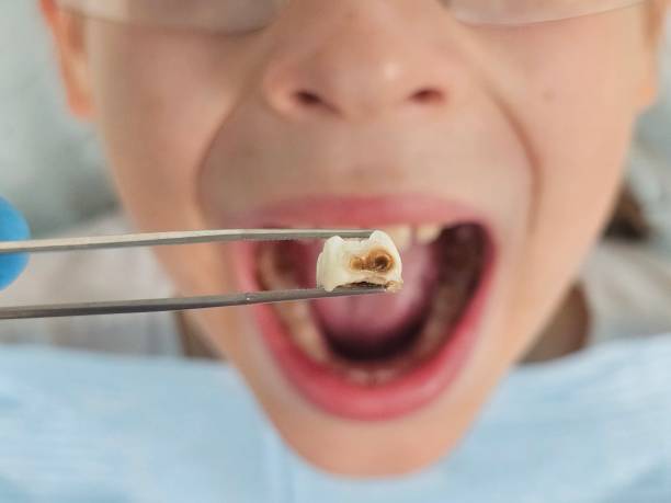Best Pediatric Emergency Dentist in Lacoochee, FL